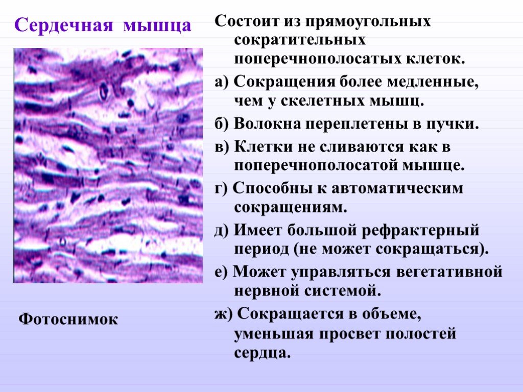 Сердечная мышца представляет собой поперечно полосатую