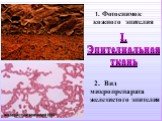 1. Фотоснимок кожного эпителия. 2. Вид микропрепарата железистого эпителия. I. Эпителиальная ткань