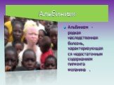 Альбинизм. Альбинизм - редкая наследственная болезнь, характеризующаяся недостаточным содержанием пигмента меланина . Альбинизм - на