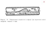 Рисунок 16 – Образование жидкостного снаряда при встречном потоке недогретой жидкости и пара