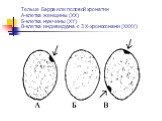 Тельце Барра или половой хроматин А-клетка женщины (ХХ) Б-клетка мужчины (ХY) В-клетка индивидуума с 3 Х-хромосомами (XXXY)