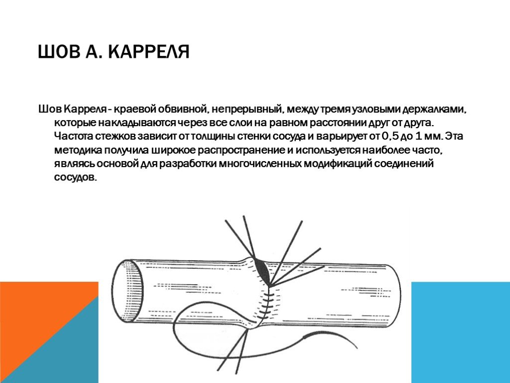 Бесшовное соединение сосудов метод а г коневского. Сосудистый шов Морозовой. Сосудистый шов Карреля и Морозовой. Шов по Каррелю методика.