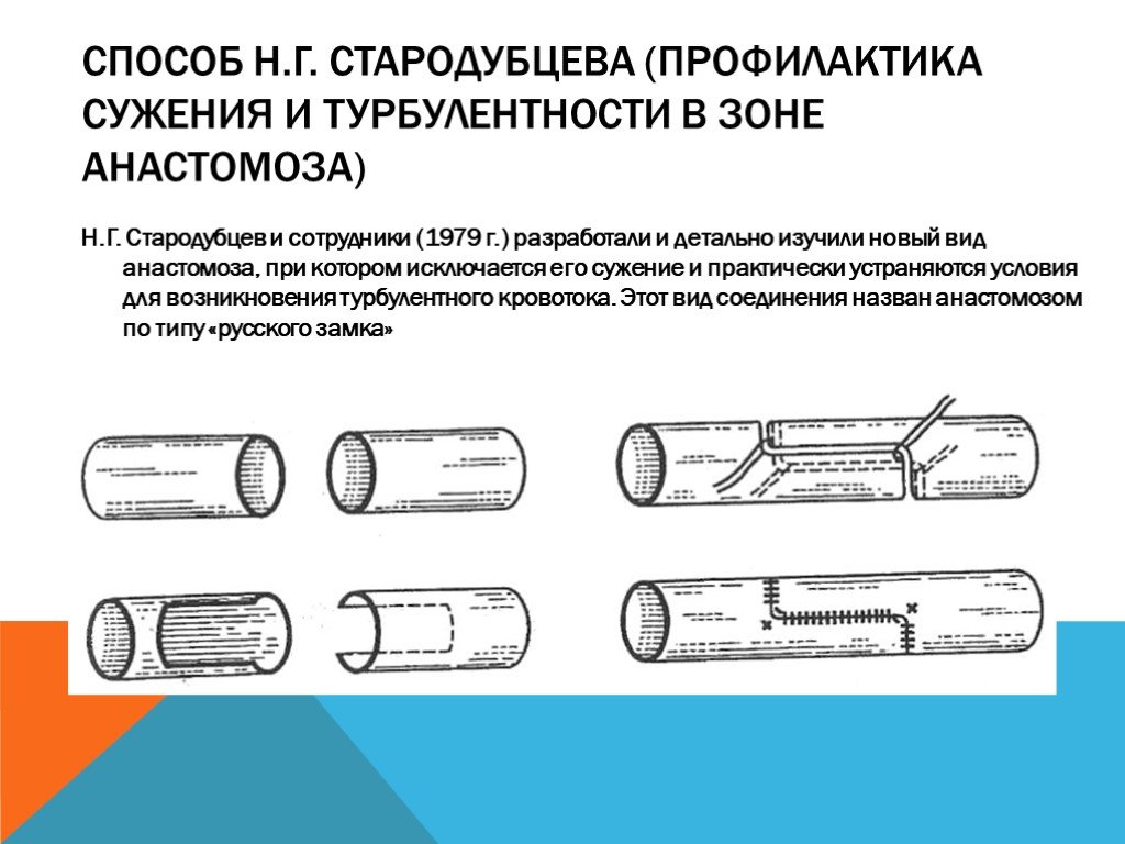 Бесшовное соединение сосудов метод а г коневского. Сужение трубы как называется. Соединение сосудов. Прием ступенчатого сужения образов.