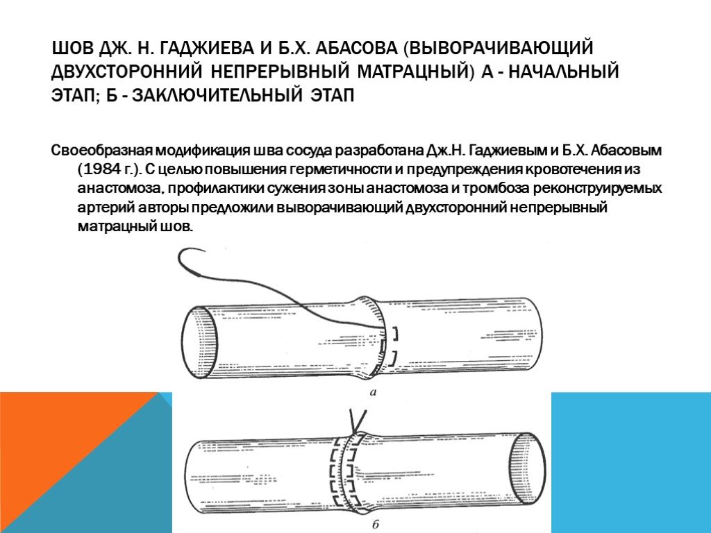 Бесшовное соединение сосудов метод а г коневского. Матрацный сосудистый шов. Непрерывный обвивной шов сосуда. Выворачивающий сосудистый шов.
