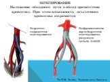 ШУНТИРОВАНИЕ Наложение обходного пути в обход препятствия кровотоку. При этом возможность остаточного кровотока сохраняется. Бедренно-подколенное шунтирование. Бифуркационное аорто-бедренное шунтирование (операция Lerisch), БАБШ. По Ю.В. Белову, Бураковскому-Бокерии