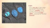 ядро. Клетки HeLa, ДНК которых окрашена голубым красителем Хёхста 33258. Центральная и правая клетки находятся в интерфазе, поэтому окрашено всё ядро. Клетка слева находится в состоянии митоза (анафаза), поэтому её ядро не видно, а ДНК сконденсирована так, что видны хромосомы