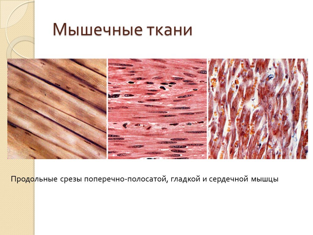 Строение клетки гладкая мышечная ткань. Поперечно Скелетная мышечная ткань. Клетки поперечно-полосатой сердечной мышечной ткани. Поперечно полосатые мышцы гладкие мышцы таблица. Продольный срез поперечно полосатой мышечной ткани.