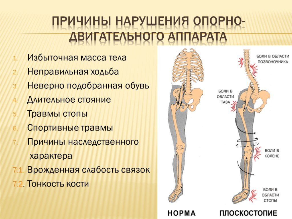 Нарушение ода. Заболевания опорно-двигательного аппарата. Опорно двигательный аппарат. Нарушение функций опорно-двигательного аппарата. Опорной двигательныфй аппарат.