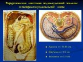 Хирургическая анатомия поджелудочной железы и панкреатодуоденальной зоны. Длинна от 15-20 см. Ширина от 3-6 см. Толщина от 2-3 см.
