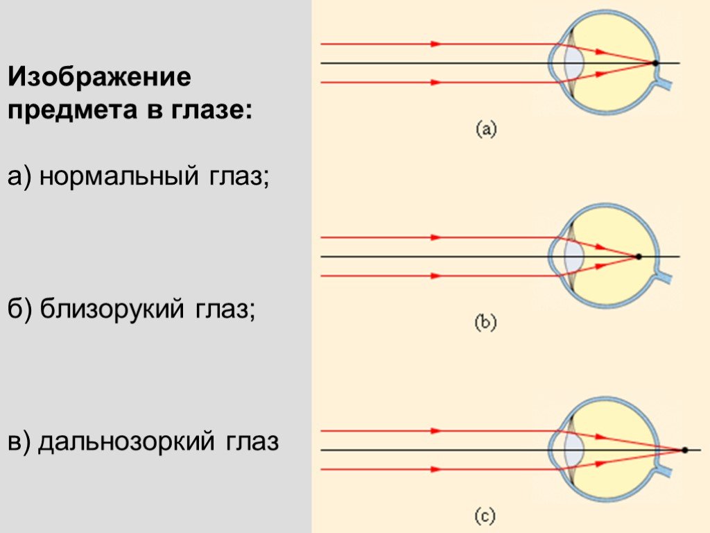 Изображение даваемое глазом