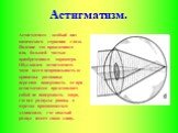 Астигматизм. Астигматизм - особый вид оптического строения глаза. Явление это врожденного или, большей частью приобретенного характера. Обусловлен астигматизм чаще всего неправильностью кривизны роговицы; передняя поверхность ее при астигматизме представляет собой не поверхность шара, где все радиус