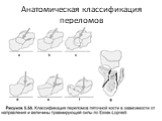 Анатомическая классификация переломов