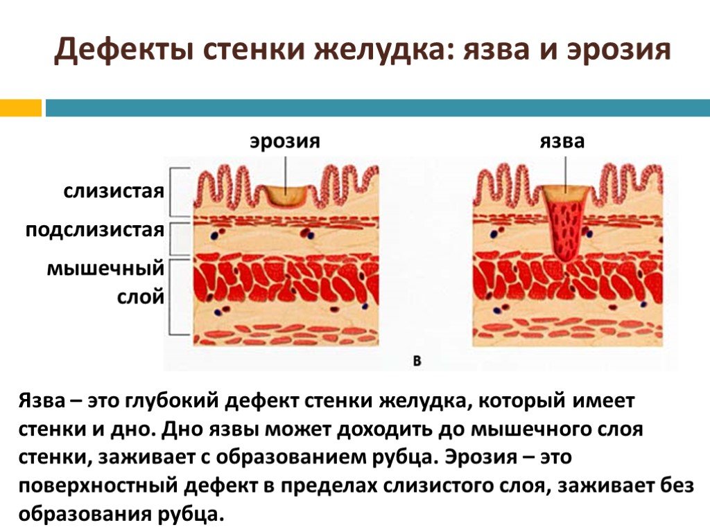 Слизистый слой. Строение слоя стенки желудка. Послойное строение стенки желудка. Строение стенки дна желудка.