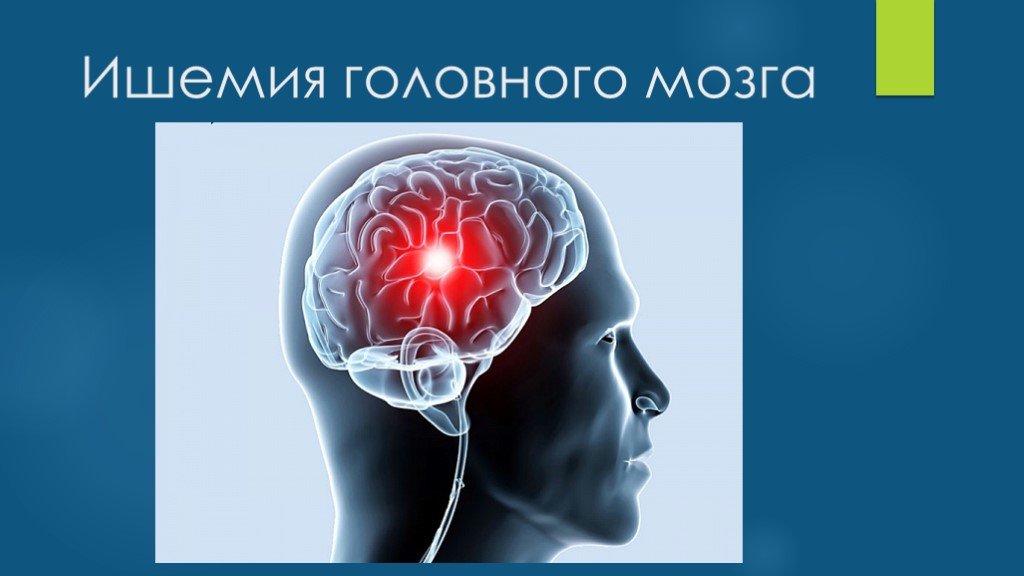 Хроническая ишемия мозга 1. Иш имия головного мозга. Ишемия мозга. Хроническая ишемия мозга.