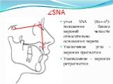 SNA S N A. угол SNA (82+-2⁰)- положение базиса верхней челюсти относительно основания черепа Увеличение угла - верхняя прогнатия Уменьшение - верхняя ретрогнатия
