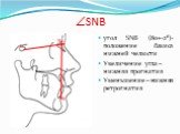 SNB. угол SNB (80+-2⁰)- положение базиса нижней челюсти Увеличение угла – нижняя прогнатия Уменьшение – нижняя ретрогнатия. B
