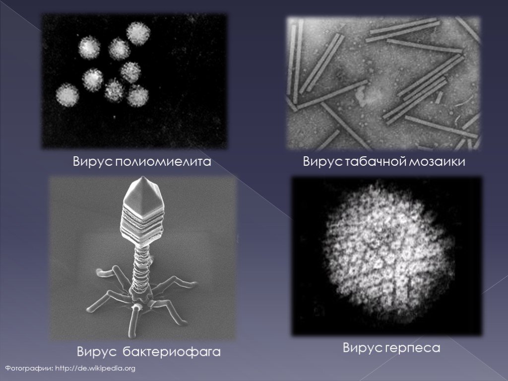Фотографию вируса и названия. Вирус табачной мозаики и бактериофаг. Вирус бактериофаг под микроскопом. Вирус полиомиелита строение вируса. Вирус полиомиелита под микроскопом.