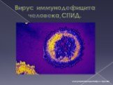 Вирус иммунодефицита человека,СПИД. Микрофотография: http://0.tqn.com