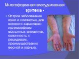 Многоформная экссудативная эритема -. Острое заболевание кожи и слизистых, для которого характерен полиморфизм высыпных элементов, склонность к рецидивам, преимущественно весной и осенью.