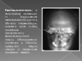 Рентгенологически: в аксиальной проекции — нарушение непрерывности кости в области переносицы, нижнего края глаза; снижение прозрачности верхнечелюстной пазухи. Обнаружении ступеньки в области турецкого седла говорит о переломе основания черепа.