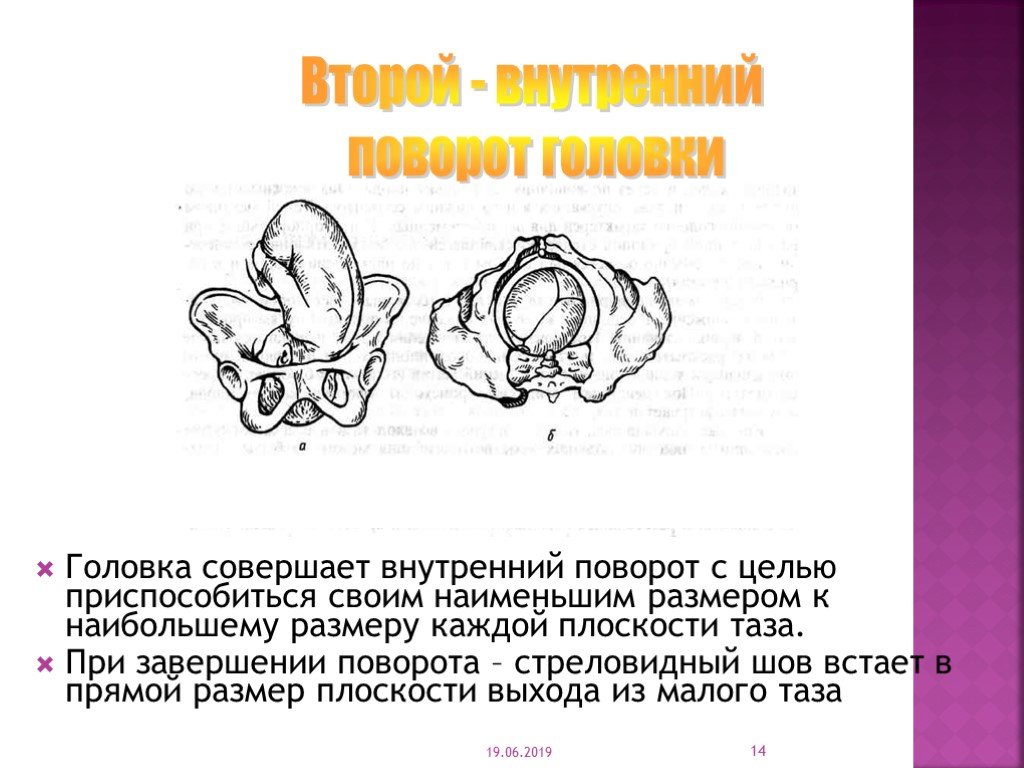 Стреловидный шов фото