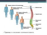 Травмы и опухоли спинного мозга