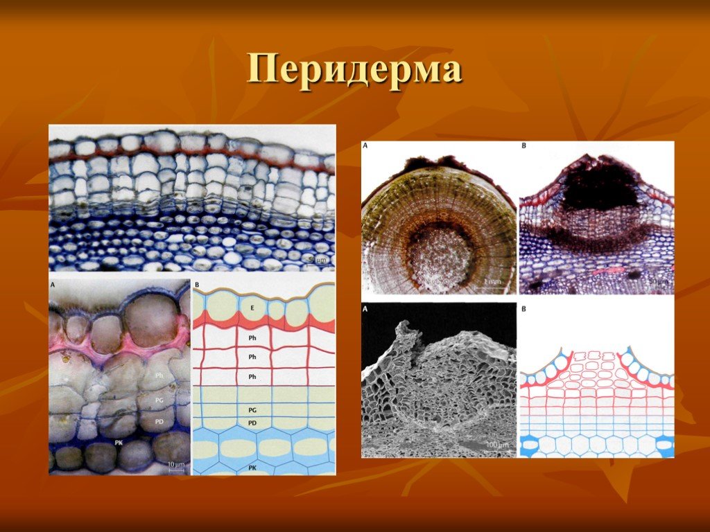 Постоянные ткани. Перидерма. Перидерма растений. Покровная ткань перидерма образована. Перидерма под микроскопом.