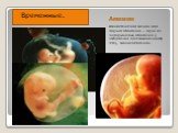 Амнион. Амниотический мешок или Водная оболочка — одна из зародышевых оболочек у эмбрионов пресмыкающихся, птиц, млекопитающих. Временные.