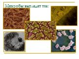 Микробы выглядят так: