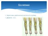Переломы, растяжения коленного сустава; Дефекты ног;