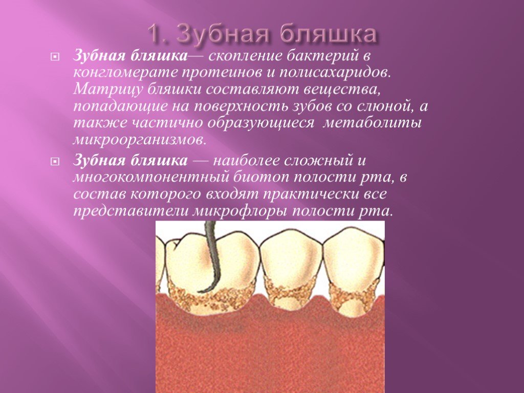 Почему зубы отличаются между собой. Зубная бляшка и зубной налет.