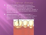 1. Зубная бляшка. Зубная бляшка— скопление бактерий в конгломерате протеинов и полисахаридов. Матрицу бляшки составляют вещества, попадающие на поверхность зубов со слюной, а также частично образующиеся метаболиты микроорганизмов. Зубная бляшка — наиболее сложный и многокомпонентный биотоп полости р