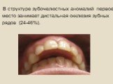 В структуре зубочелюстных аномалий первое место занимает дистальная окклюзия зубных рядов (24-46%).
