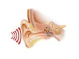Методы компенсации нарушений слуха Слайд: 5