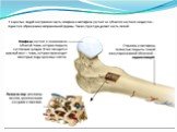 Развитие костей - остеогенез Слайд: 9