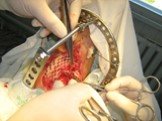 Реконструктивно-восстановительная хирургияТрансплантология Слайд: 91