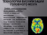 Технологии визуализации головного мозга. Диффузная оптическая томография (ДОТ) — способ медицинской визуализации, использующий инфракрасное излучение для изображения тела человека. Технология измеряет оптическую абсорбцию гемоглобина и опирается на его спектр поглощения в зависимости от насыщения ки