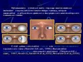 Офтальмологи в течение всего периода восстановления оказывают пациентам симптоматическую помощь, которая заключается в устранении двоения и вынужденного компенсаторного положения головы. С этой целью назначается полная или сегментарная окклюзия пораженного глаза (Noorden G.K. von, 1996). Выполняется