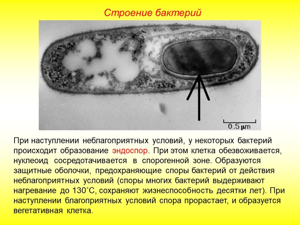 При наступлении неблагоприятных условий амеба. Строение споре бактериальной клетки. Спора бактерий строение. Строение эндоспоры бактерий. Строение споры бактерий.