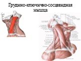 Грудино-ключично-сосцевидная мышца