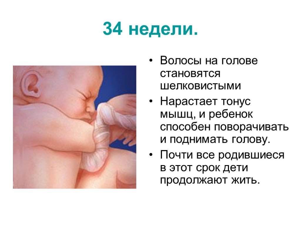 Три недели ребенку поднимает головку. Тонус 34 неделя