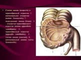 Слепая кишка (вскрыта) и червеобразный отросток. 1 - илеоцекальное отверстие (ostium ileocaecale); 2 - подвздошная кишка (ileum); 3 - отверстие червеобразного отростка (ostium appendicis vermiformis); 4 - червеобразный отросток (appendix vermiformis); 5 - слепая кишка (caecum); 6 - илеоцекальный кла