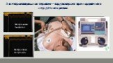Электроимпульсная терапия – кардиоверсия при нарушениях сердечного ритма. Фибрилляция желудочков