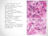 1 - бластная клетка (IV класс): крупная, со светлым ядром и голубой (без зернистости) цитоплазмой; 2А - базофильные эритробласты: крупные клетки с большим ядром и базофильной цитоплазмой; 2Б - полихроматофильный эритробласт: клетка меньшего размера, цитоплазма — серовато-розовая; 2В - оксифильные эр