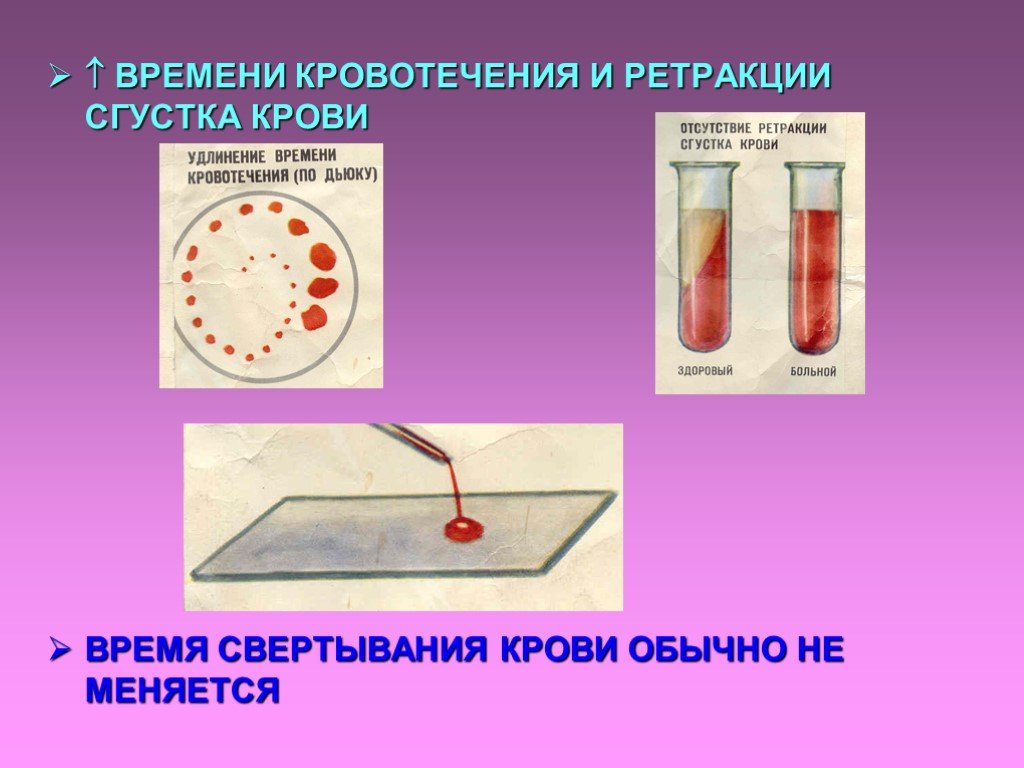 Свертывание крови тест. Методы определения свертываемости крови. Определение времени свертывания крови. Метод определения времени свертывания крови. Методы определения длительности кровотечения.