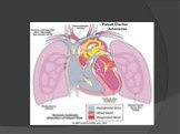 Открытый артериальный (боталлов) проток сердца Слайд: 12