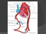 Открытый артериальный (боталлов) проток сердца Слайд: 3