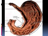 Анатомия  и топография желудка и его пищеварительных желез, тонкой и толстой кишки. Особенности у детей. Слайд: 47