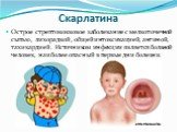 Скарлатина. Острое стрептококковое заболевание с мелкоточечной сыпью, лихорадкой, общей интоксикацией, ангиной, тахикардией. Источником инфекции является больной человек, наиболее опасный в первые дни болезни.