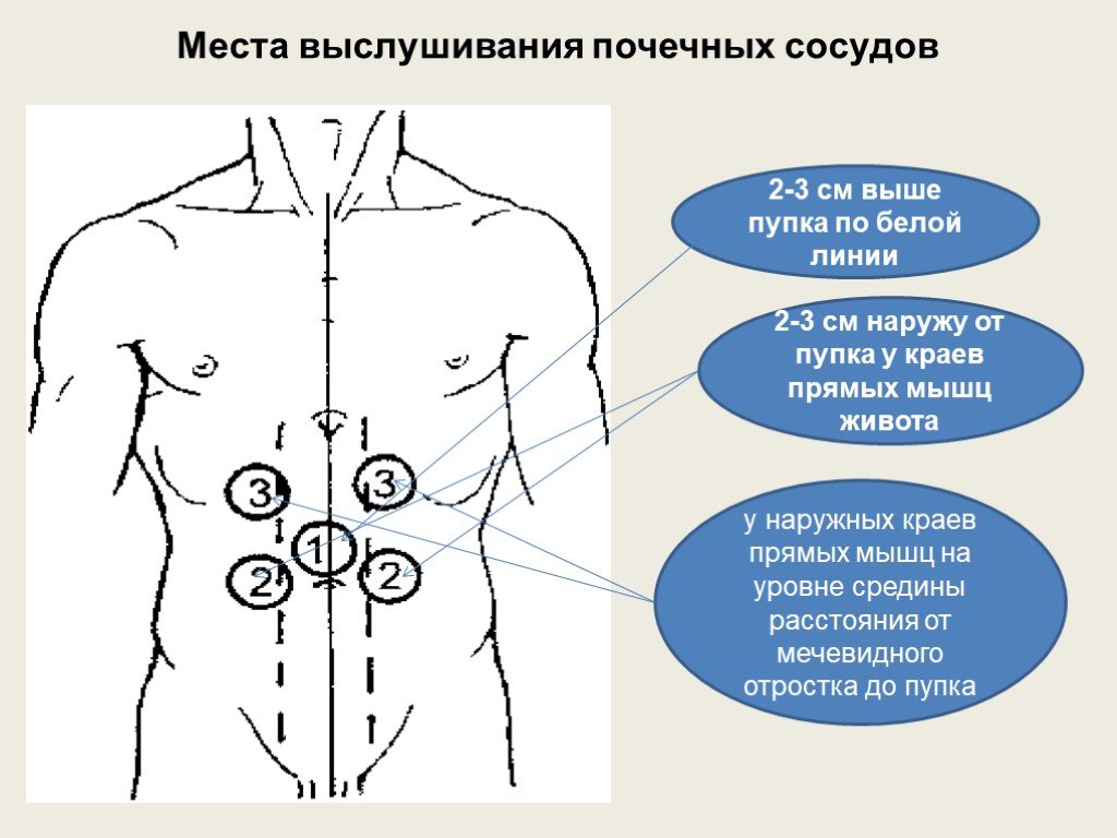 Боль выше пупка у мужчин. Схема болей в животе у мужчины. Точка справа от пупка. Болит левее и выше пупка.